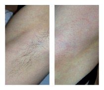 Работы До и После 13