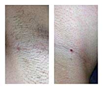 Работы До и После 14