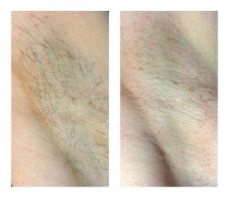 Работы До и После 15