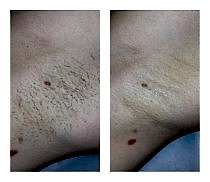 Фото До и После 4