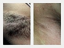 Работы До и После 19