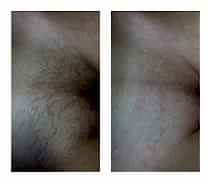 Работы До и После 7