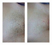 Работы До и После 8