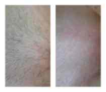 Работы До и После 9