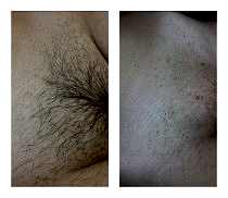 Фото До и После 4