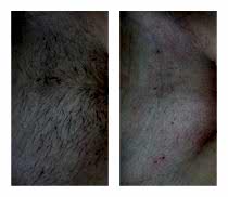 Фото До и После 5