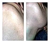 Работы До и После 18