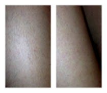 Работы До и После 10