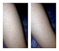 Работы До и После 11