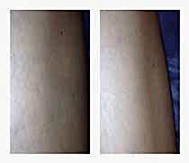 Работы До и После 12