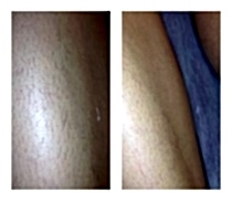 Фото До и После 5