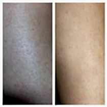 Фото До и После 1