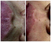 Работы До и После 17