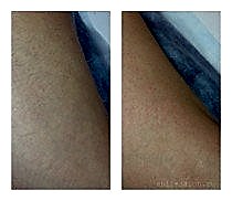 Работы До и После 20