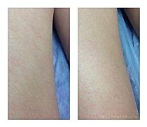 Работы До и После 21