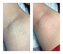 Работы До и После 22