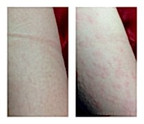 Фото До и После 6