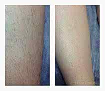 Фото До и После 7