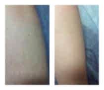 Фото До и После 8