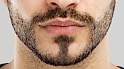 Мужская эпиляция лица