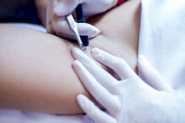 Обучение электроэпиляции в Алматы