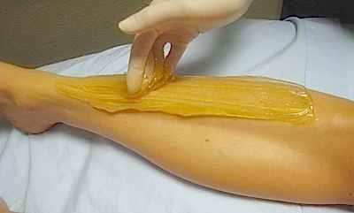 Процедура эпиляции карамелью