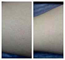 Работы До и После 4