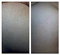 Работы До и После 5