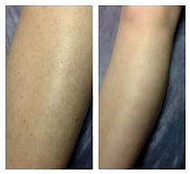 Работы До и После 6