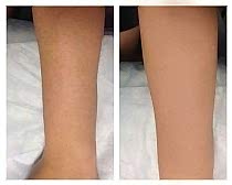 Работы До и После 3