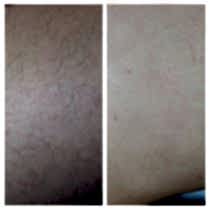 Работы До и После 2