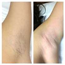 Работы До и После 1