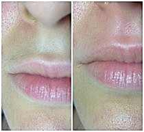 Работы До и После 16